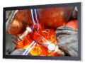 27" Medical Monitor