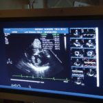medical monitors, medical displays, surgical touchscreens, clinical touch screens