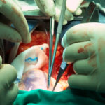 medical lcd panel, medical touch screen, medical grade monitor, surgical display, clinical display