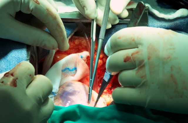 medical lcd panel, medical touch screen, medical grade monitor, surgical display, clinical display
